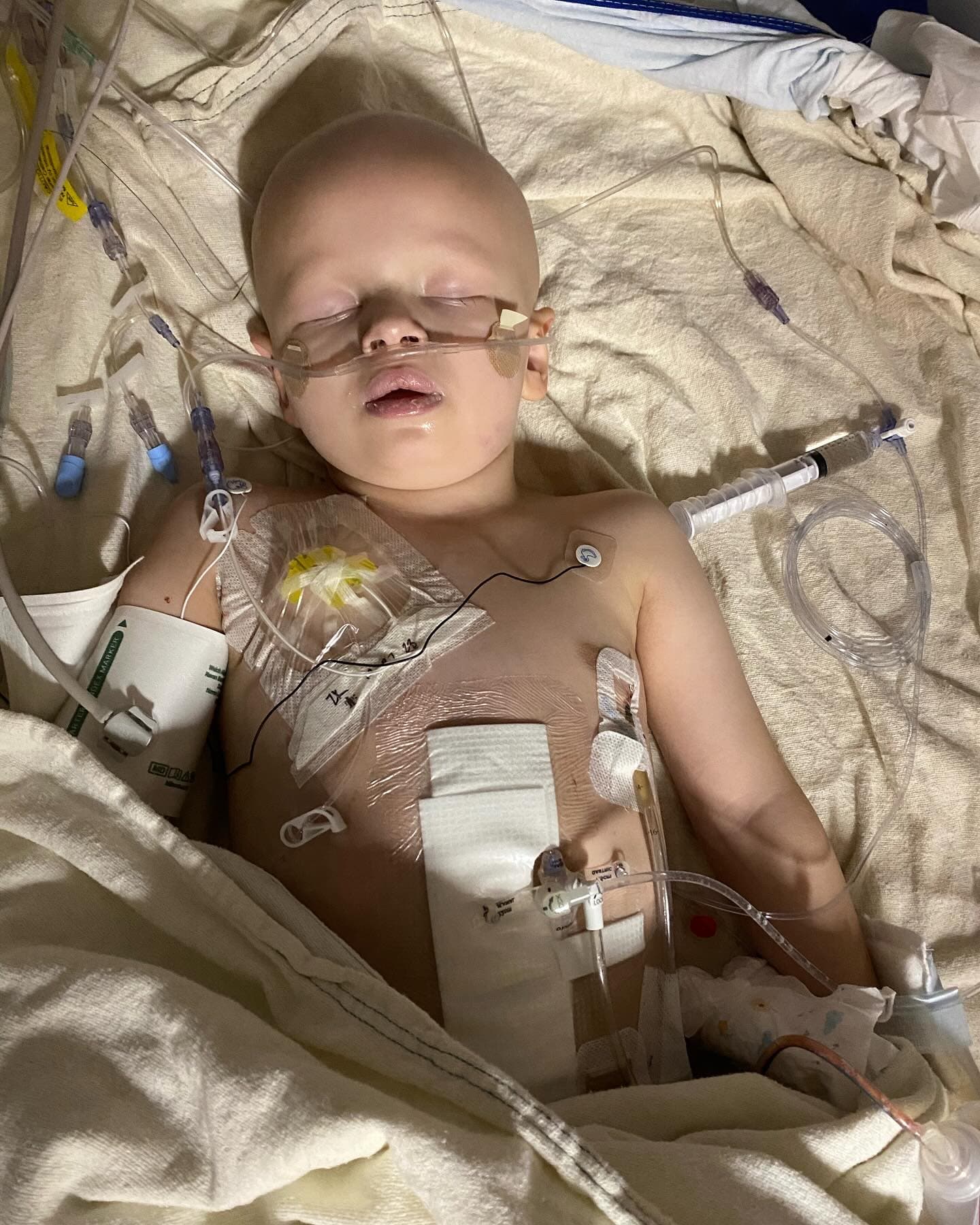 Ajude o pequeno Isaac na luta contra um neuroblastoma em estádio IV