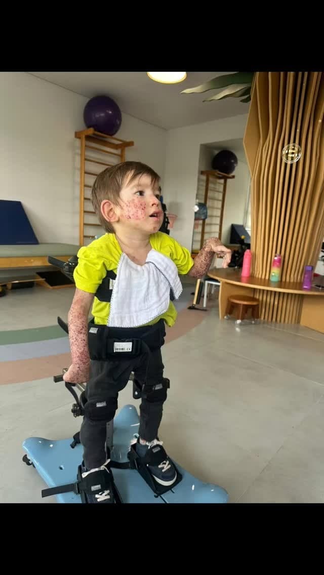 Ajude o Pequeno Joaquim a Lutar Contra uma Síndrome Genética Rara - Photo 1